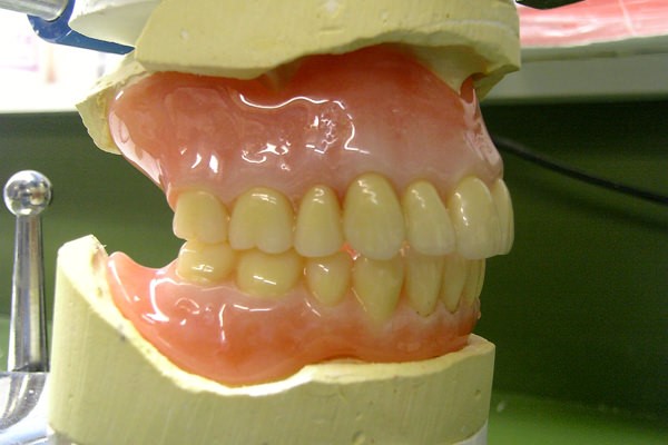Jaw Registration For Partial Dentures Lagrange IN 46761